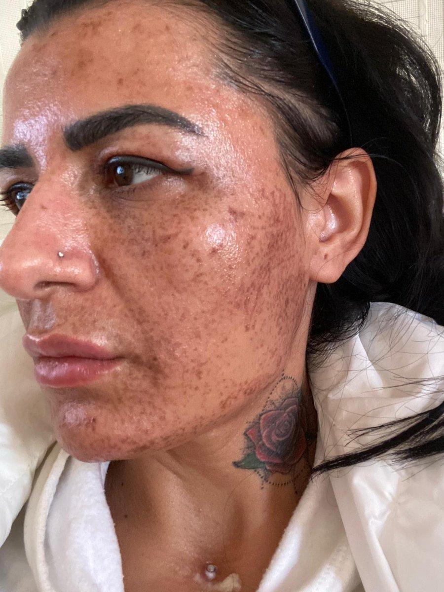 Antalya'da güzellik salonuna giden kadın hayatının şokunu yaşadı