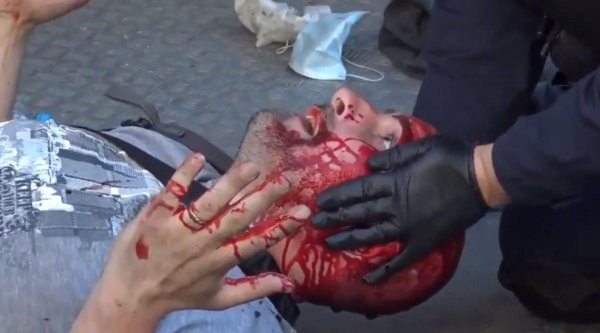 Amerika ve Avrupa'dan polis şiddetinin görüntüleri