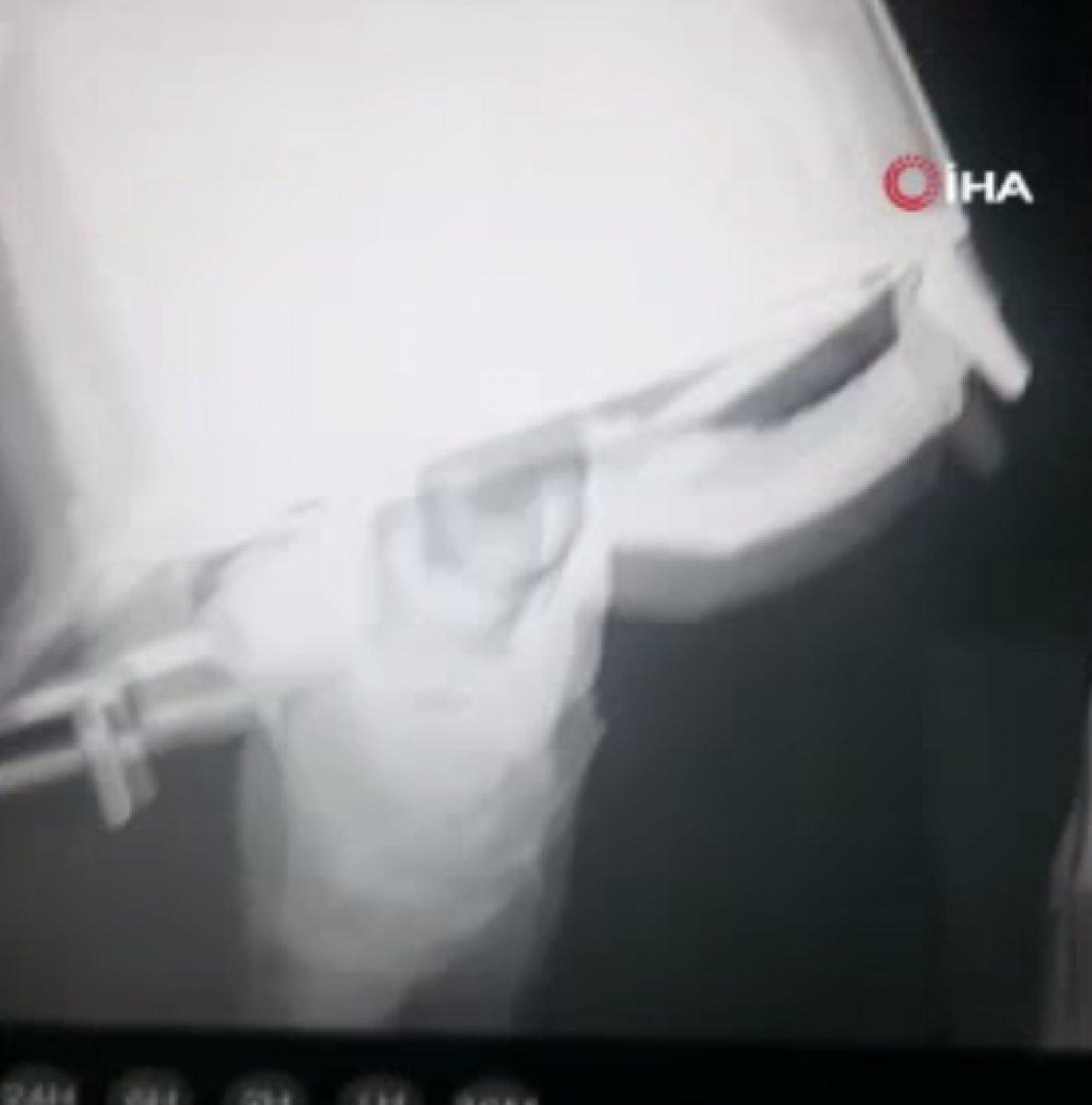 Ankara'da 2 mobilya hırsızı, suçüstü yakalandı