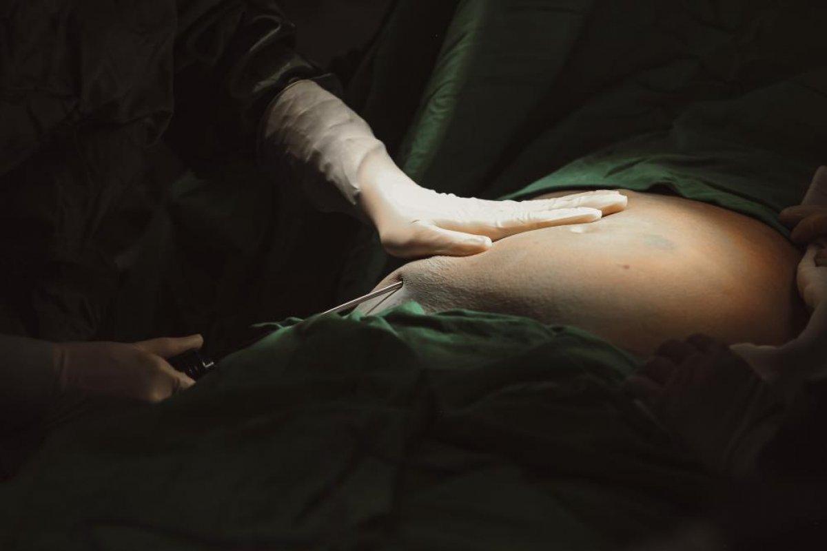 4D teknolojisi, dünyada ilk kez Türkiye'de yanık tedavisi için kullanılıyor.