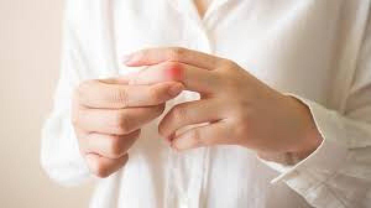 Lupus (kelebek hastalığı) nedir, belirtileri nelerdir? Lupus hastalığı tedavisi var mı?