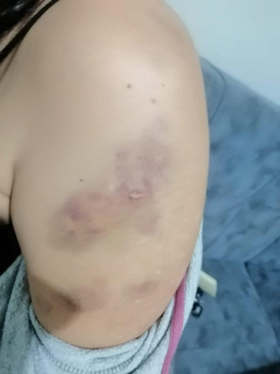 İzmir'de kirayı geciktiren kadına darp