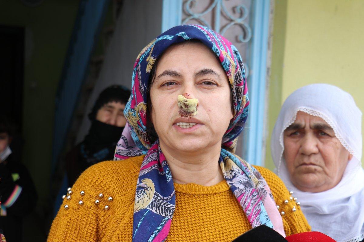 Malatya’da 8 sokak köpeği kadına saldırdı