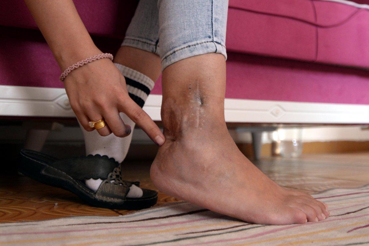 Mersin'de pompalı tüfek ile eski eşini vuran şahıs 