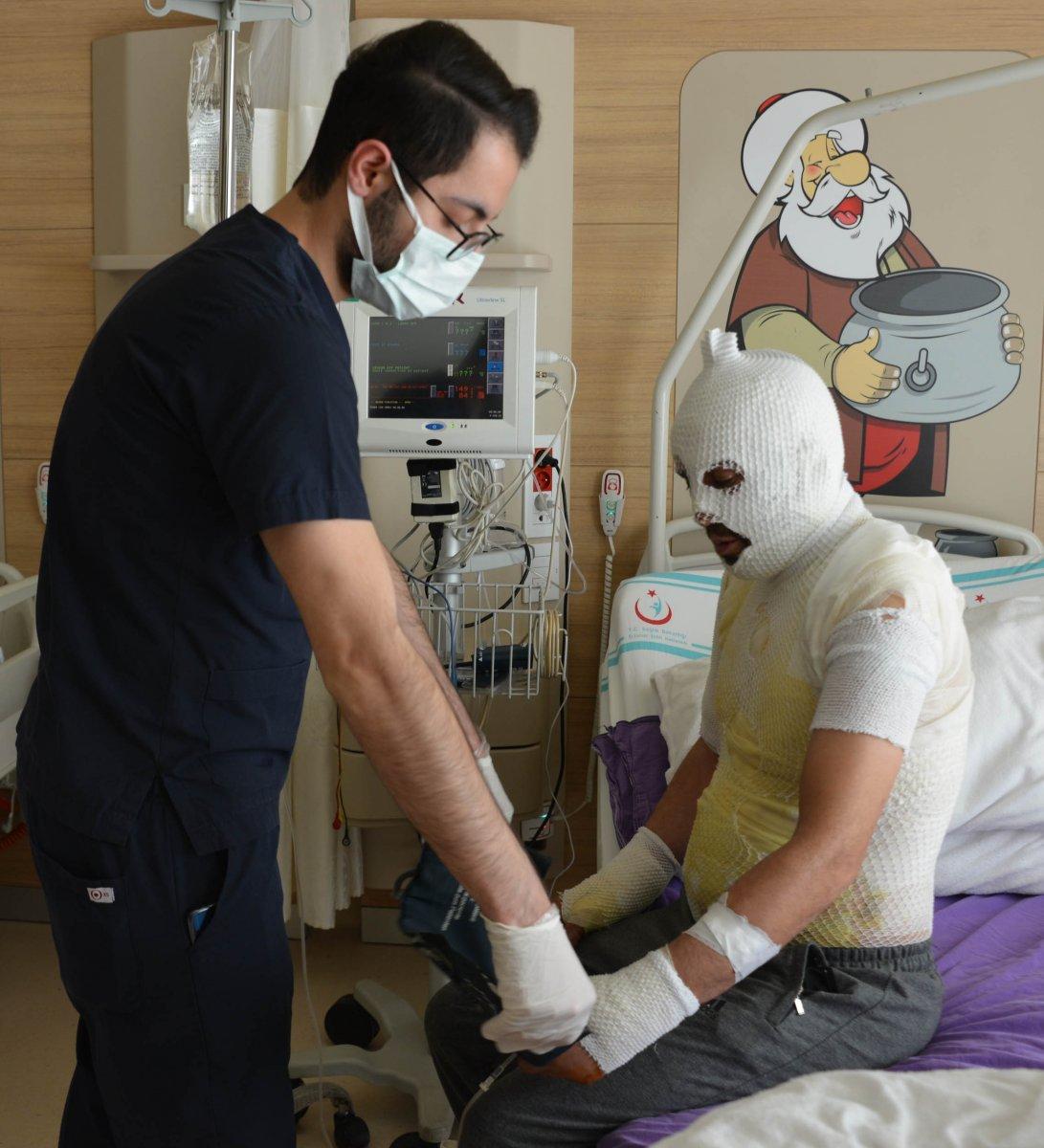 Iğdır'da taciz iddiası sonrası sobadan devrilen su ile yandı