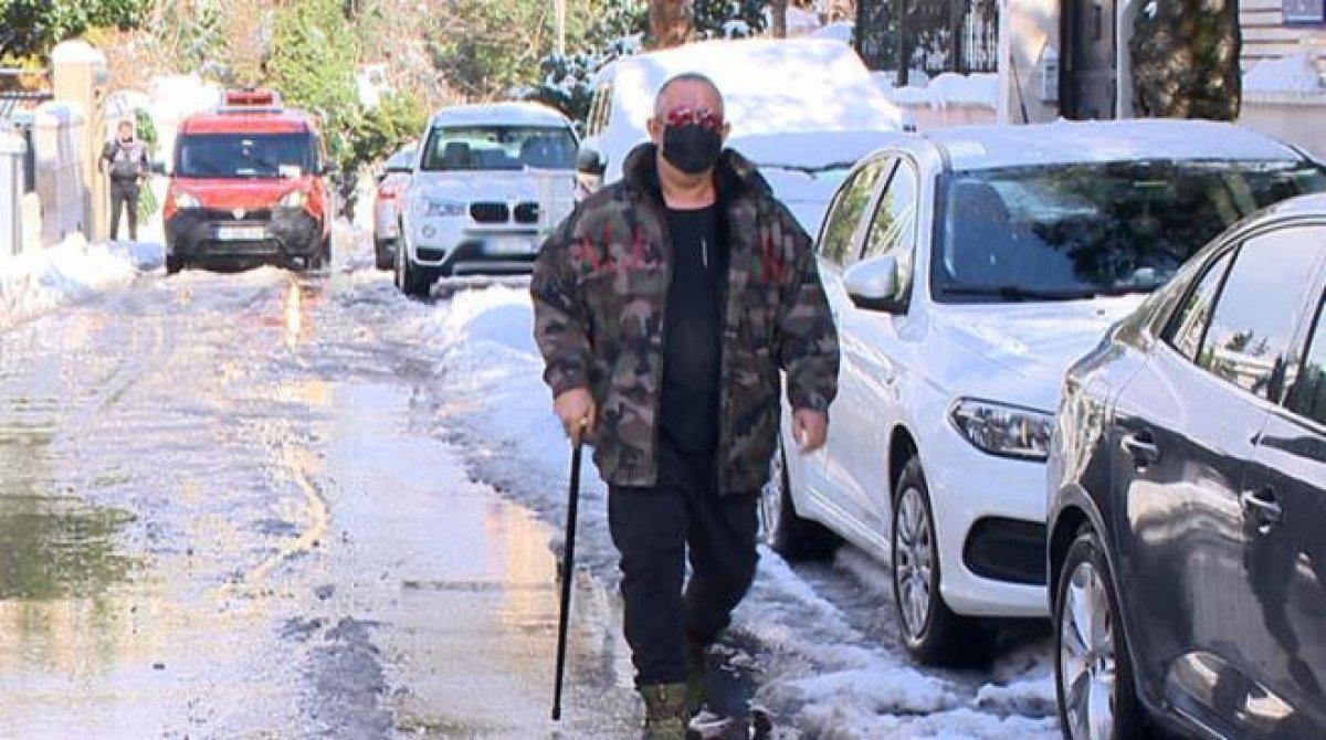 Cem Yılmaz bastonla yürüyor