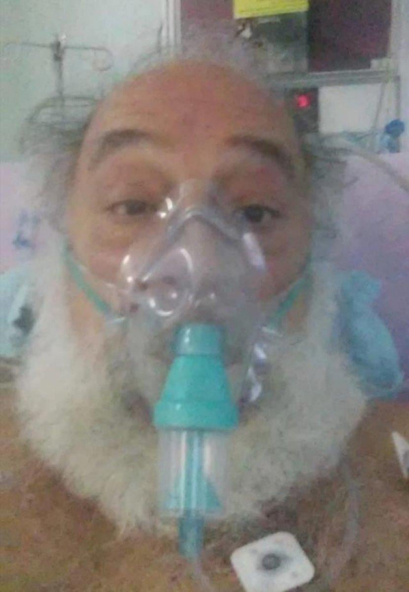 Toygun Ateş, koronavirüse yenik düştü