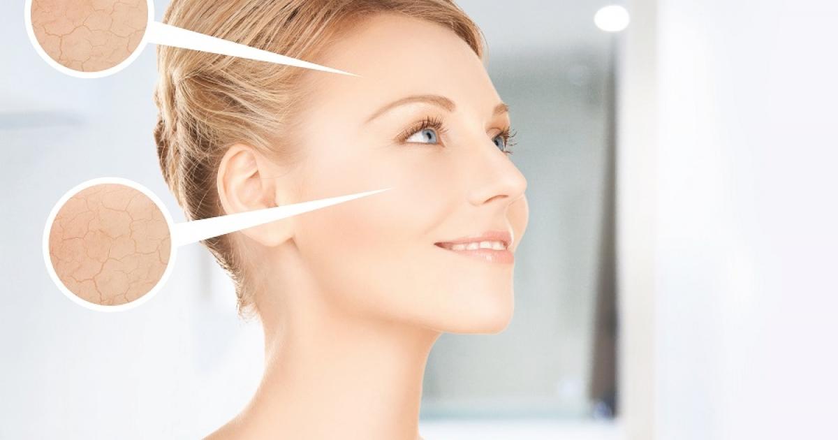 Soğuk havalarda cildinizin bariyerini koruyun