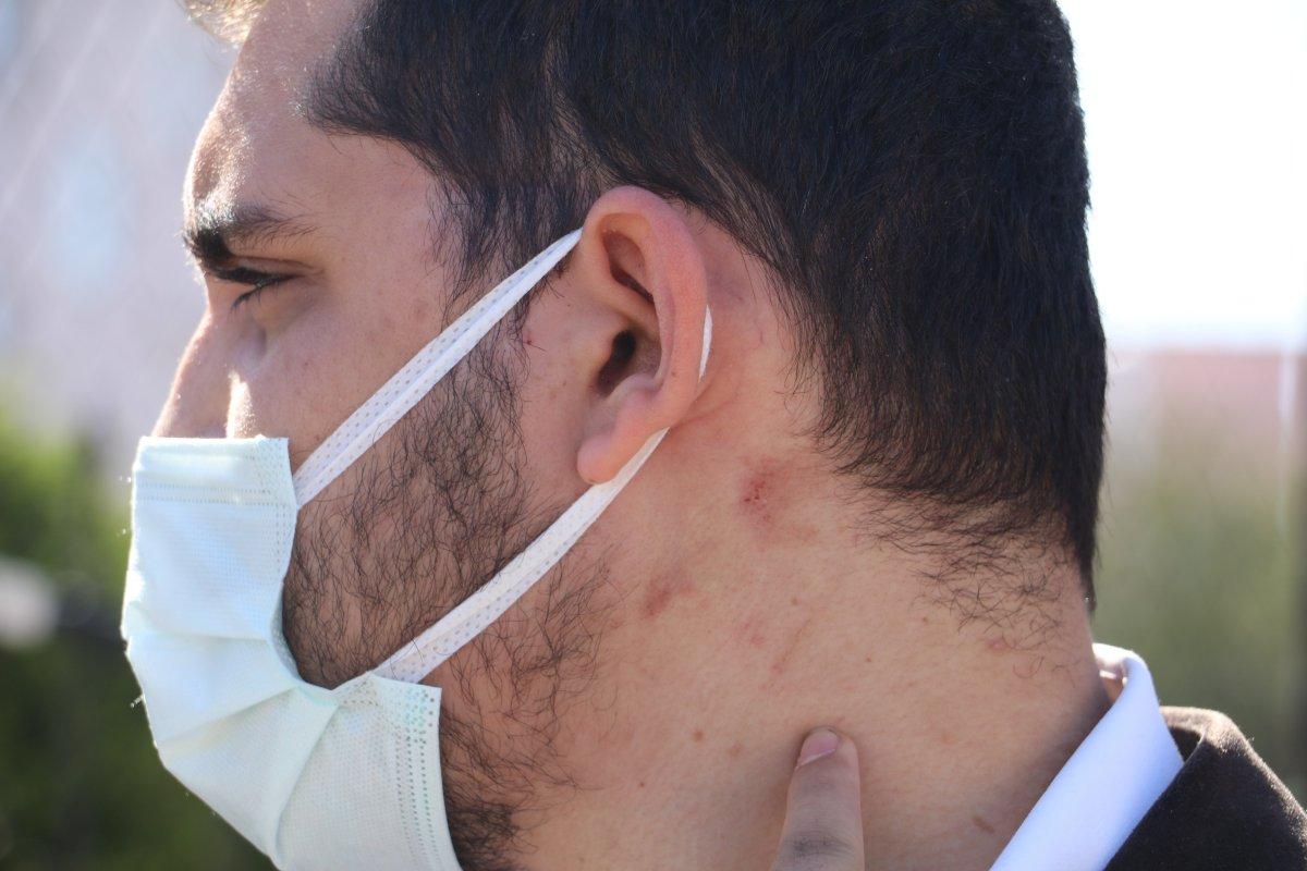 Antalya'da yüzde 90 engelli adamı öldüresiye darbettiler