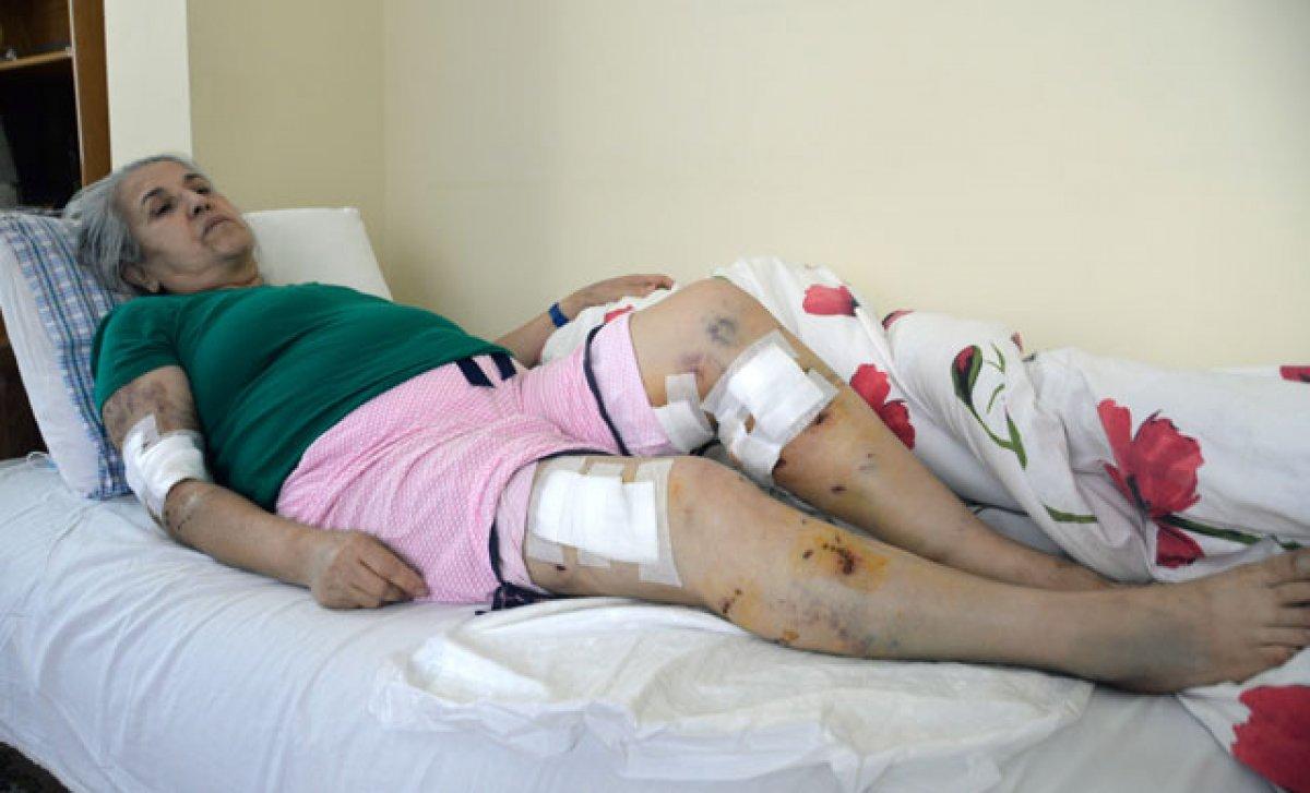 Mersin'de sokak köpeklerinin saldırısına uğrayan kadın