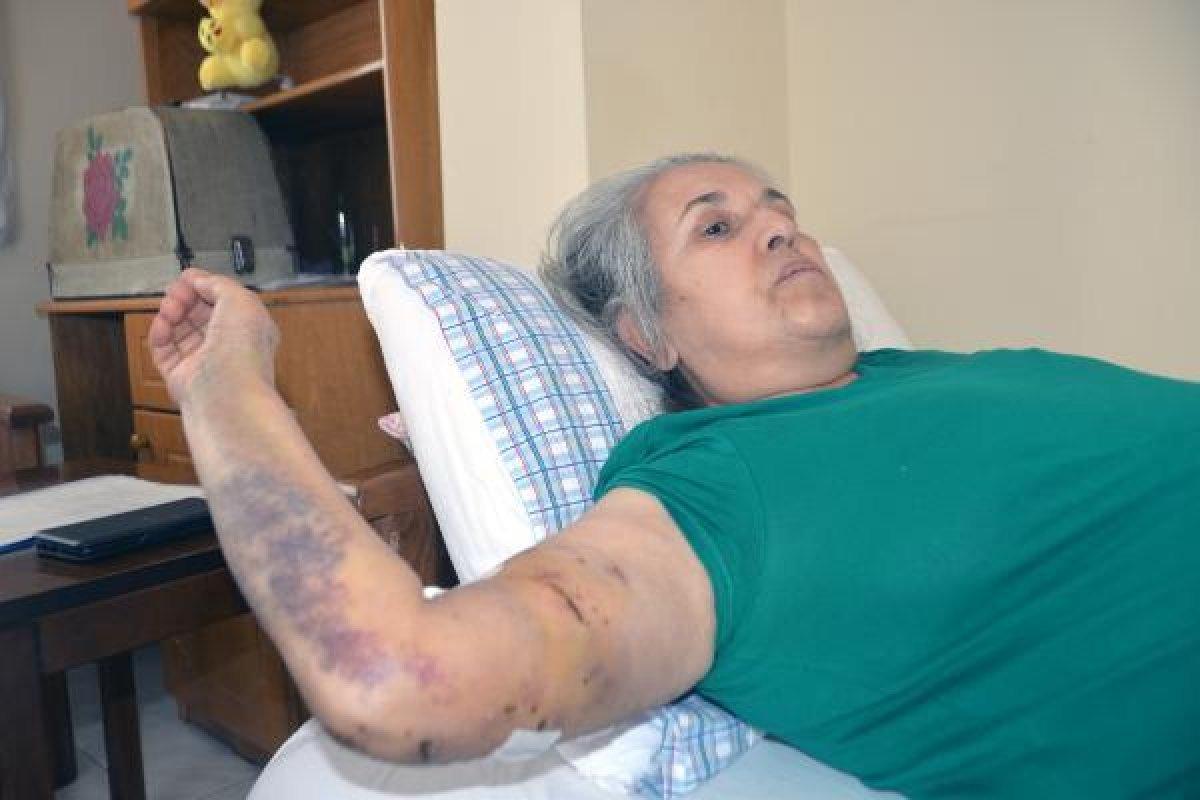 Mersin'de sokak köpeklerinin saldırısına uğrayan kadın