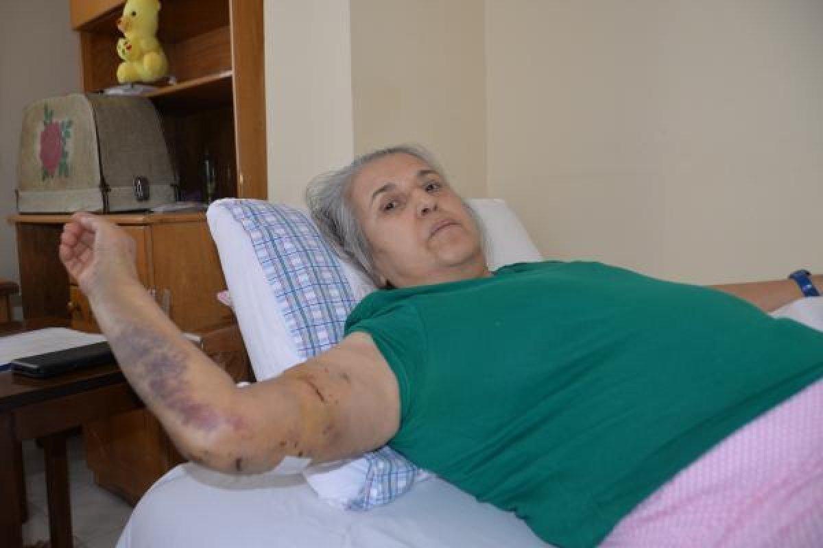 Mersin'de sokak köpeklerinin saldırısına uğrayan kadın