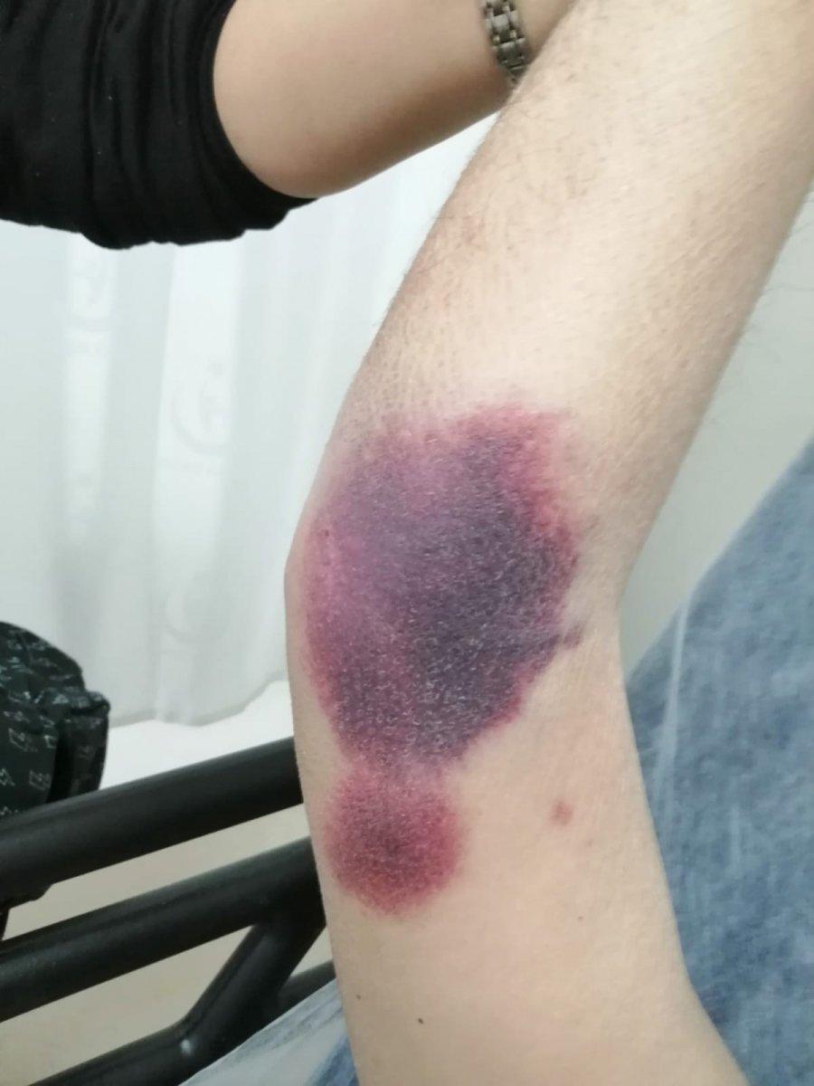 Antalya'da engelli kişiyi darbeden şahıs tutuklandı