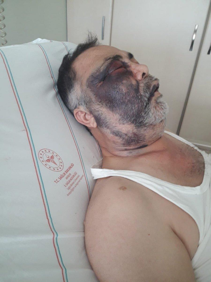 Antalya'da engelli kişiyi darbeden şahıs tutuklandı