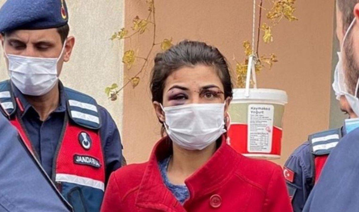 Örselenmiş Kadın Sendromu nedir? Ceza hukukunda Örselenmiş Kadın Sendromu..