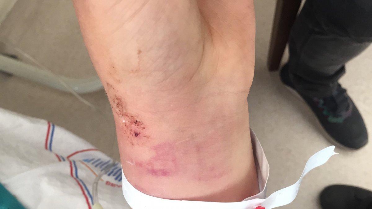 Adana'da eşini darbetti: Sakinleştirmek için kolunu ısırdım