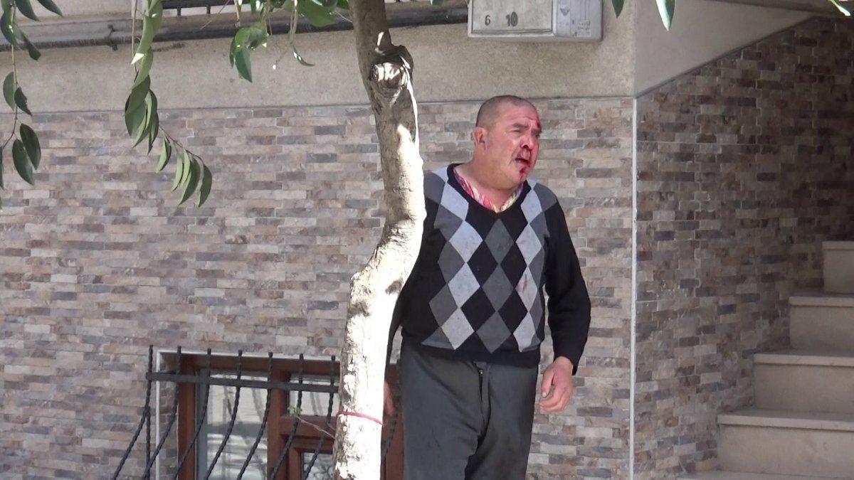 Sultangazi'de engelli bir vatandaşa otobüs çarptı