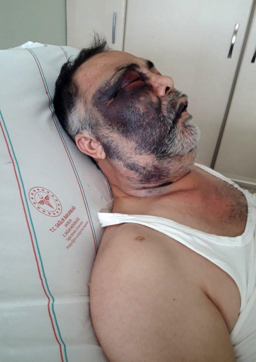 Antalya'da darbedilen yüzde 90 engelli yaşamını yitirdi