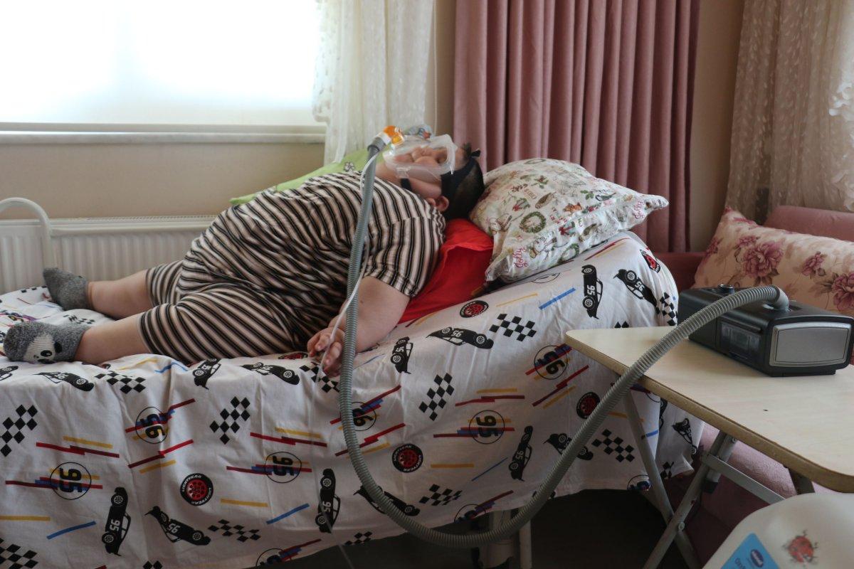 Samsun'da 5 yaşındaki çocuk 90 kiloya ulaştı