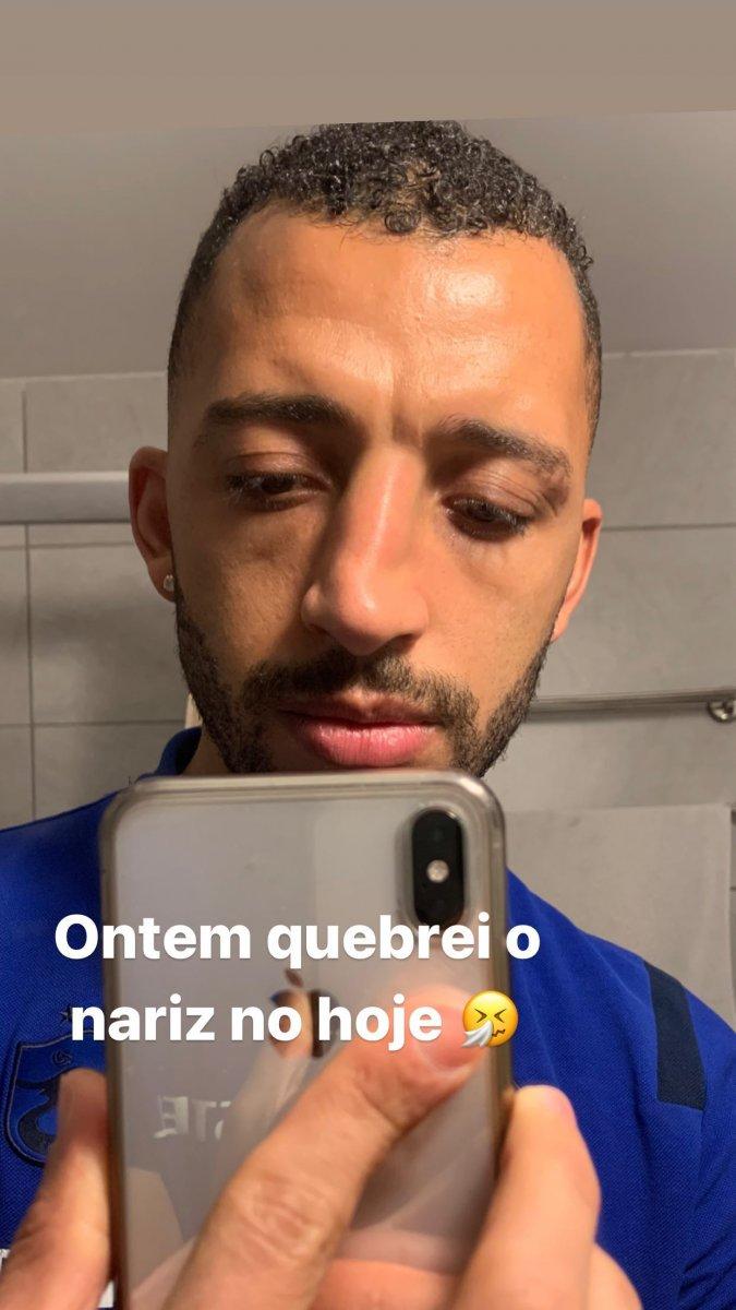 Vitor Hugo'nun burnunda kırık tespit edildi