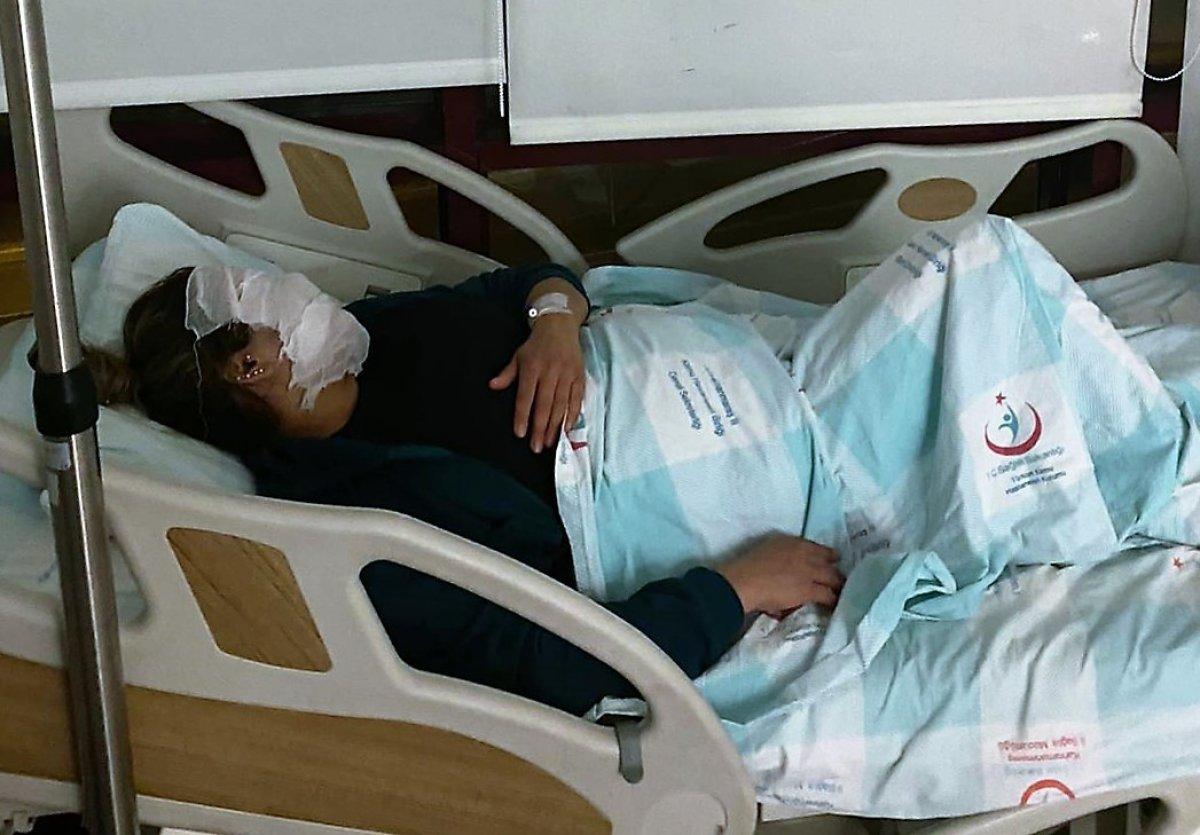 Kahramanmaraş'ta güzellik merkezine giden kadının yüzü yandı