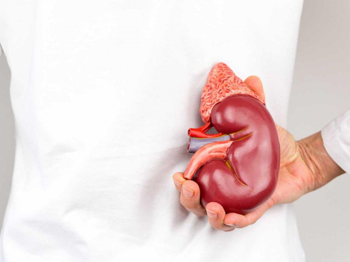 Böbrek taşlarını önlemek için beslenme ipuçları