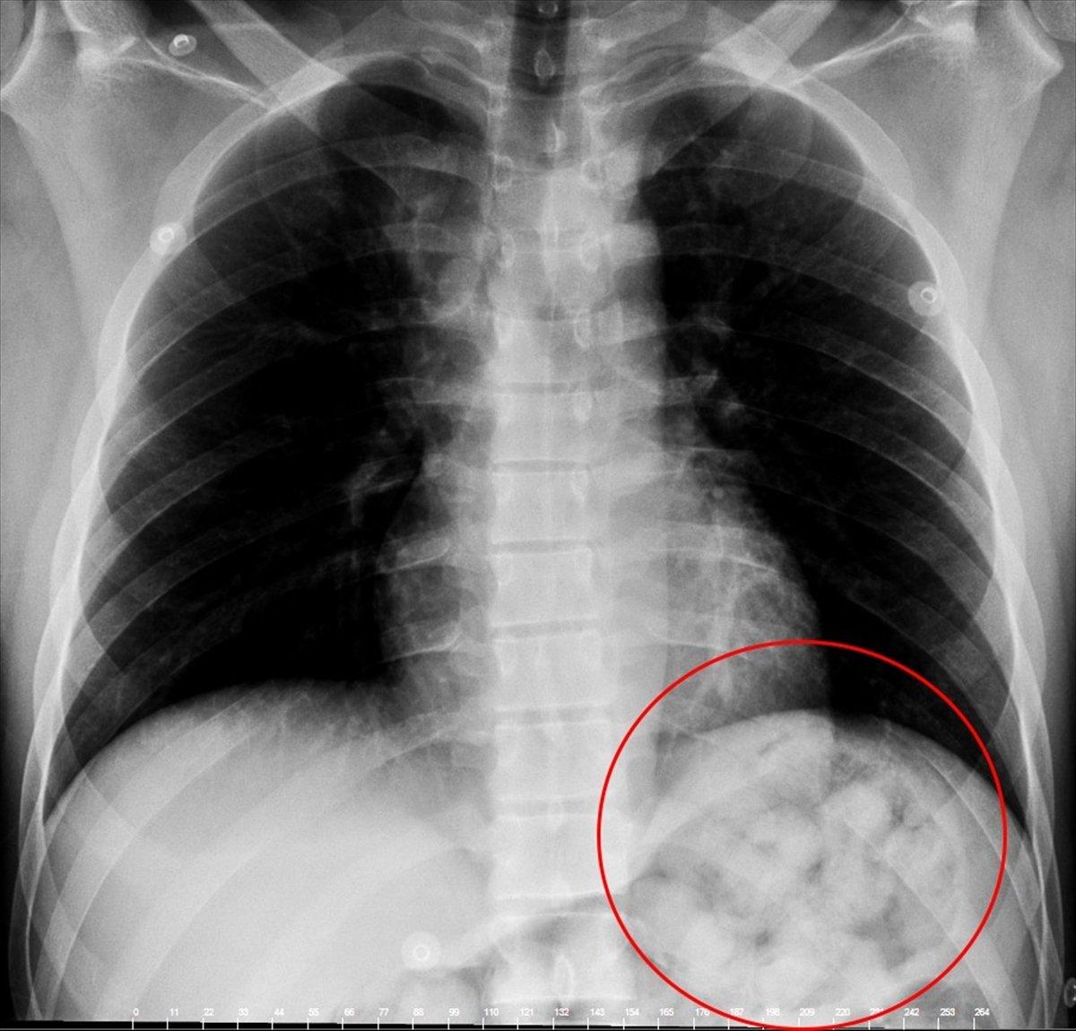 İranlı uyuşturucu