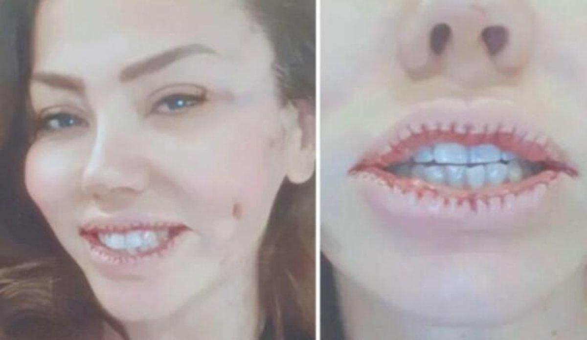 Lara, dudaklarını küçülttü