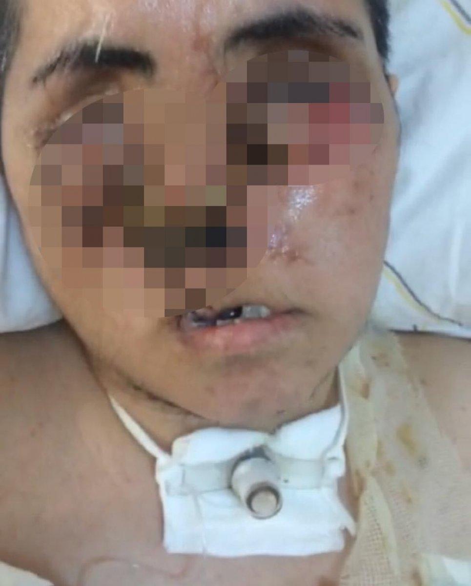 Diyarbakır'da eniştesinin saldırısı sonucu tanınamaz hale geldi