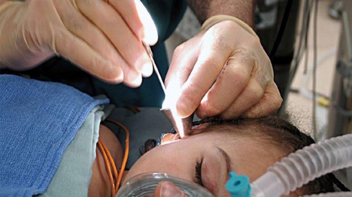 Kulak zarı neden delinir? Kulak zarı delinmesi (patlaması) belirtileri neler, nasıl tedavi edilir?