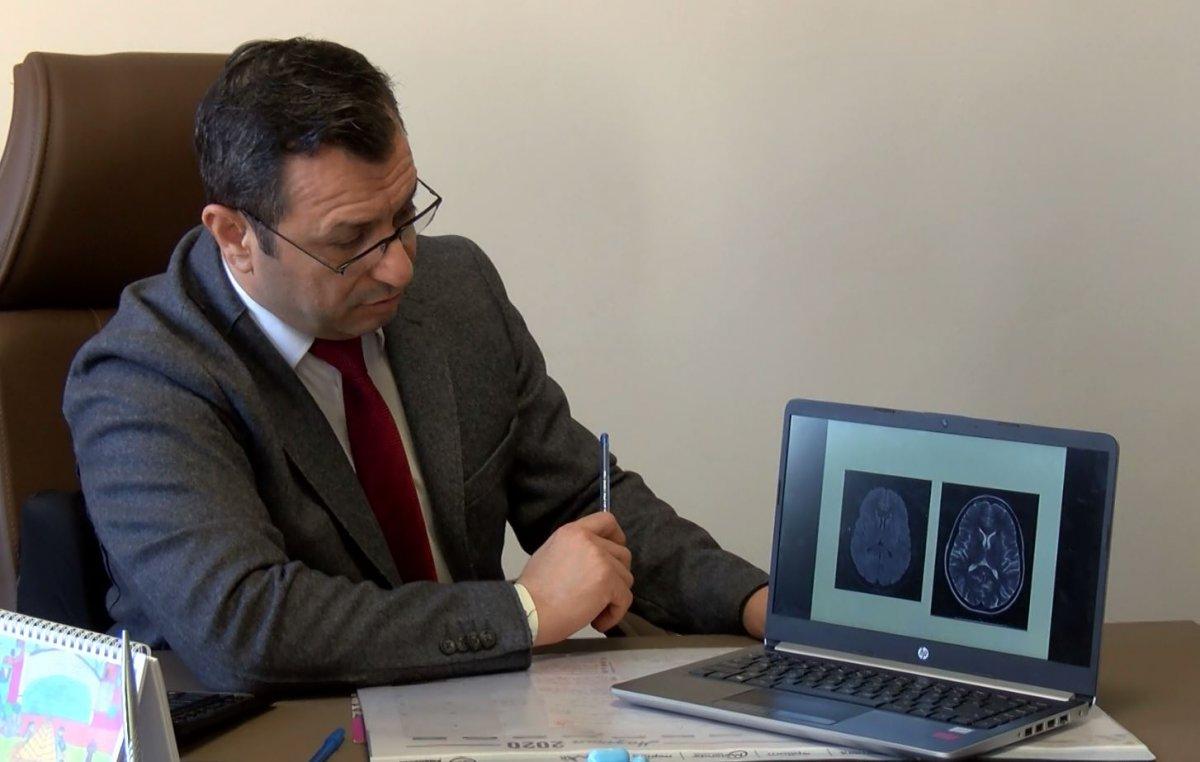 Koronavirüs hastalarında yüzde 30 oranında baş ağrısı tespit edildi