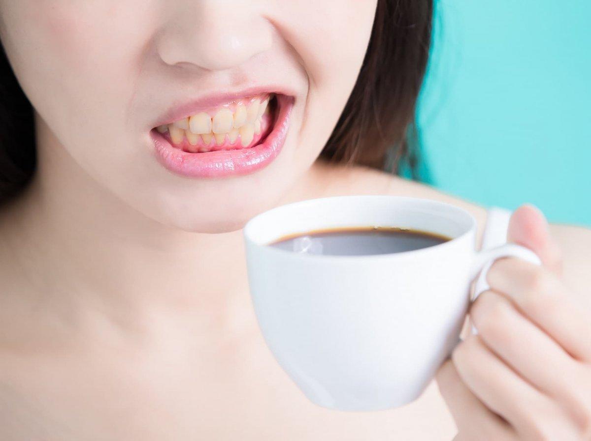 Dişleriniz için en iyi ve en kötü gıdalar