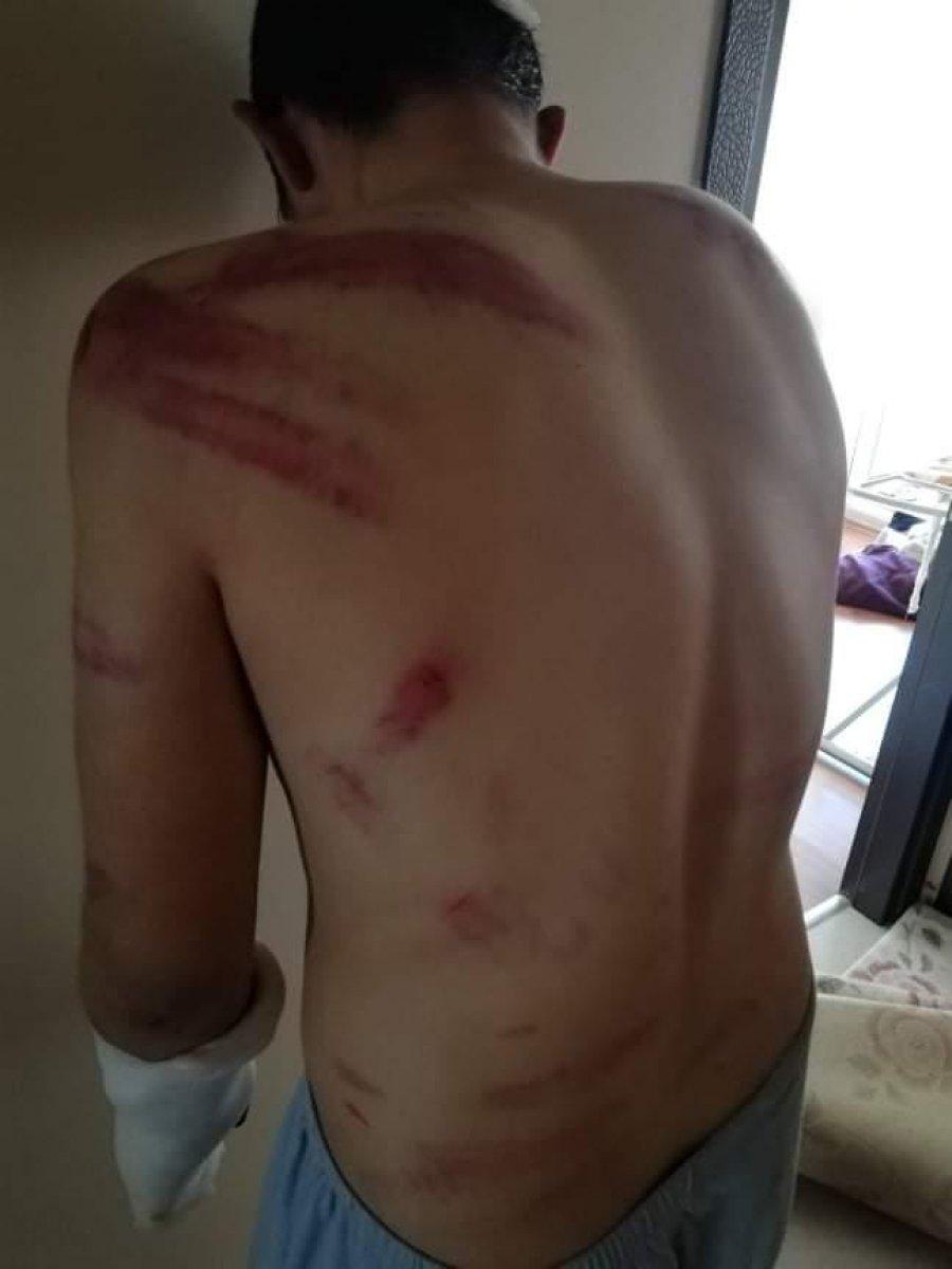 Afyonkarahisar'da, patronlarından 5 saat işkence gören çırak