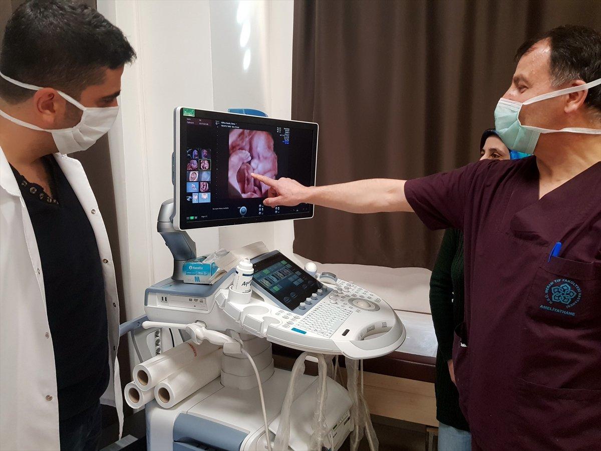 Göbek kordonundan kan nakli yapılan bebek yaşama tutundu