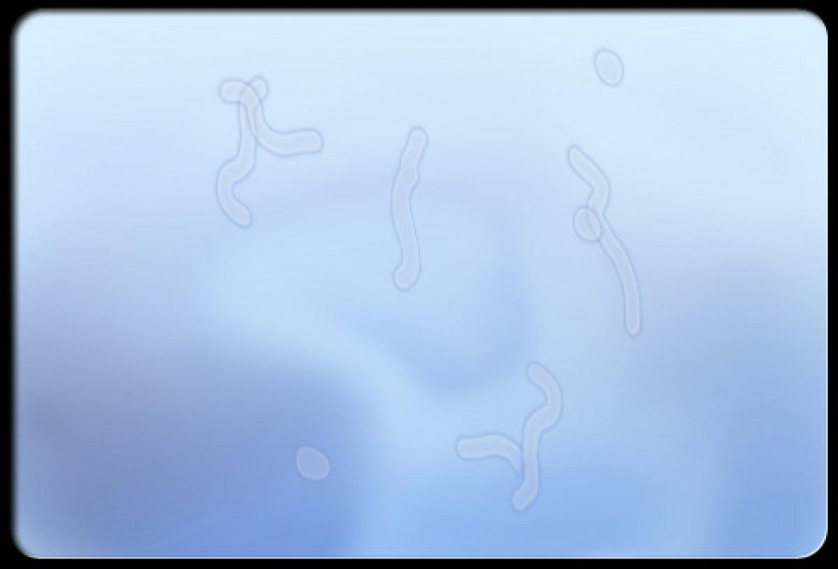 Gözünüzde uçuşan ipliksi cisimler: Yüzer noktalar nedir