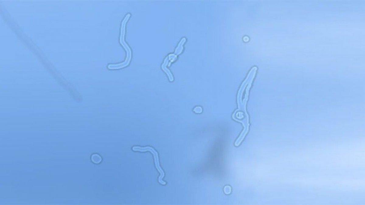 Gözünüzde uçuşan ipliksi cisimler: Yüzer noktalar nedir