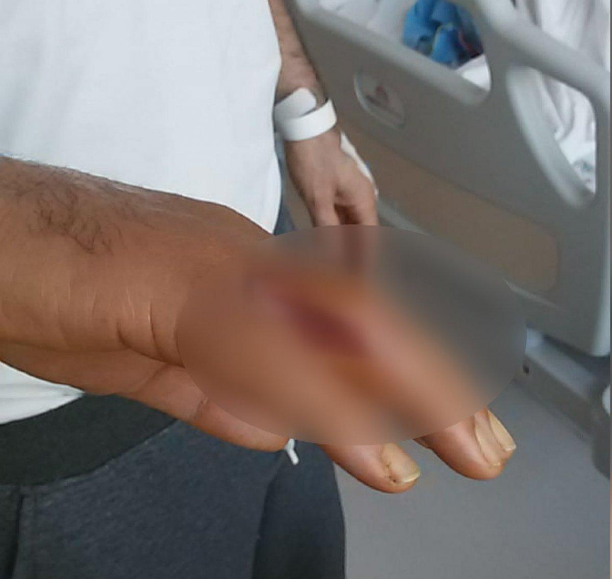 Nişantaşı'nda garsonun eline batan kürdan kabusu oldu