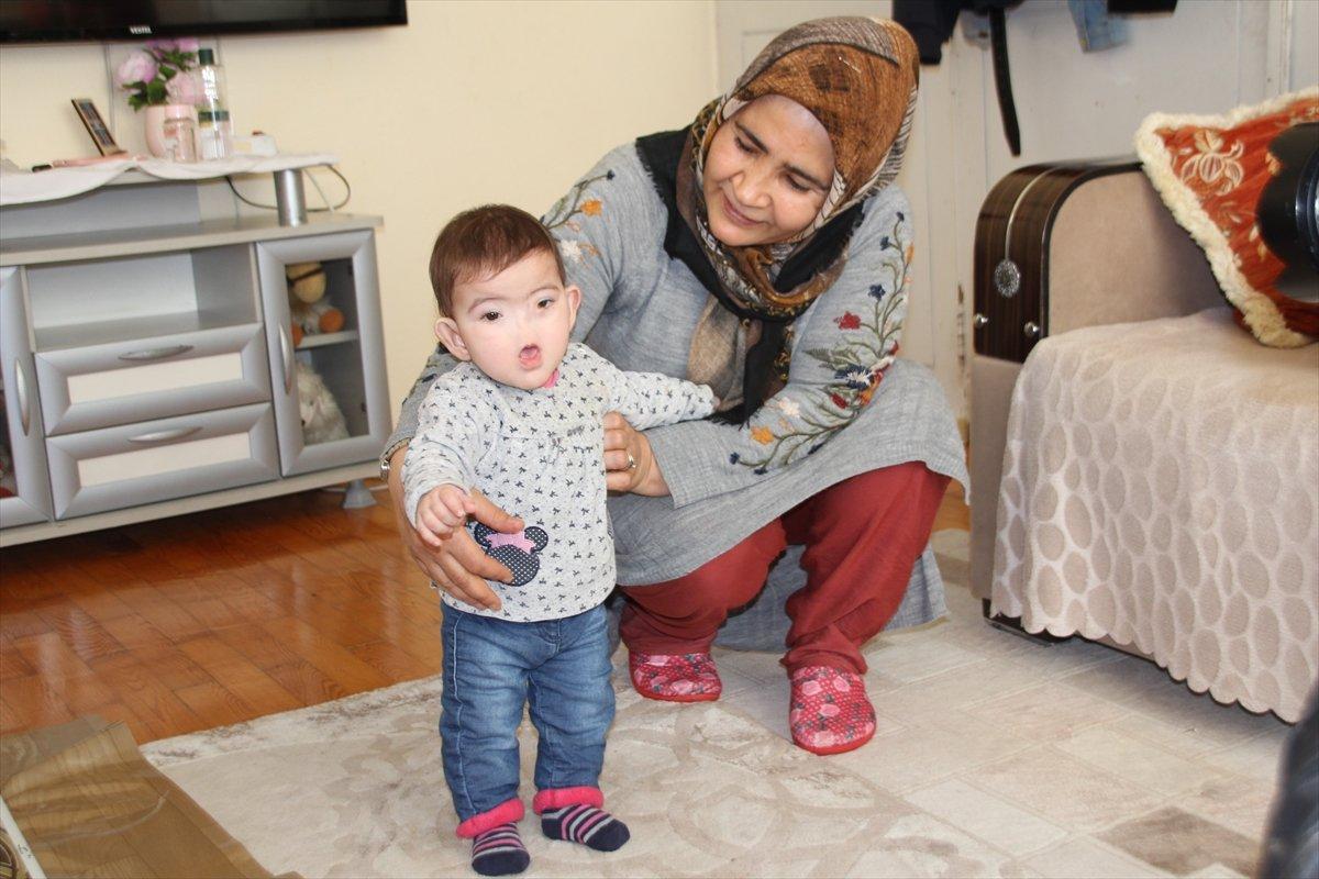 Antalyalı aile, burnu olmadan dünyaya gelen çocukları için destek bekliyor