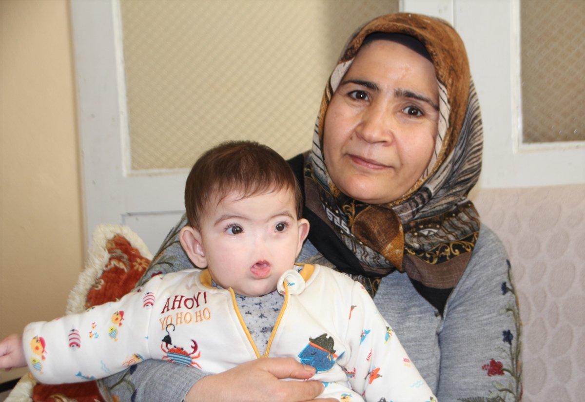 Antalyalı aile, burnu olmadan dünyaya gelen çocukları için destek bekliyor