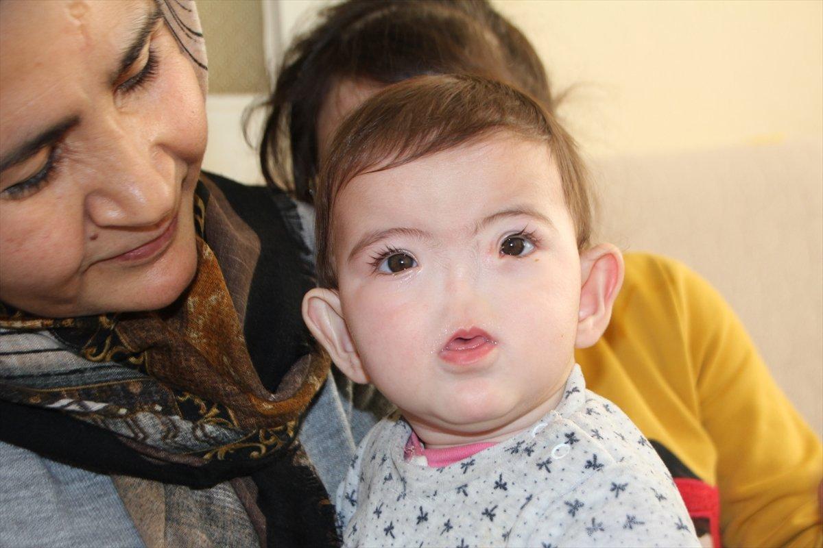 Antalyalı aile, burnu olmadan dünyaya gelen çocukları için destek bekliyor