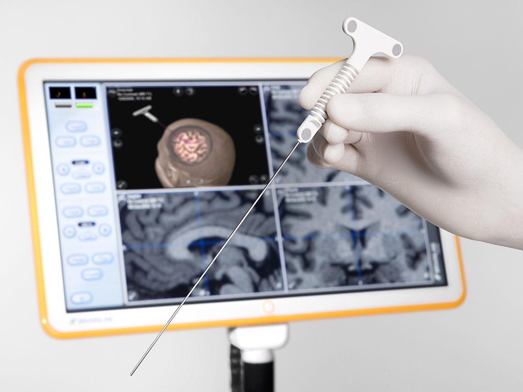 Beyin cerrahisinde nöronavigasyon sistemi