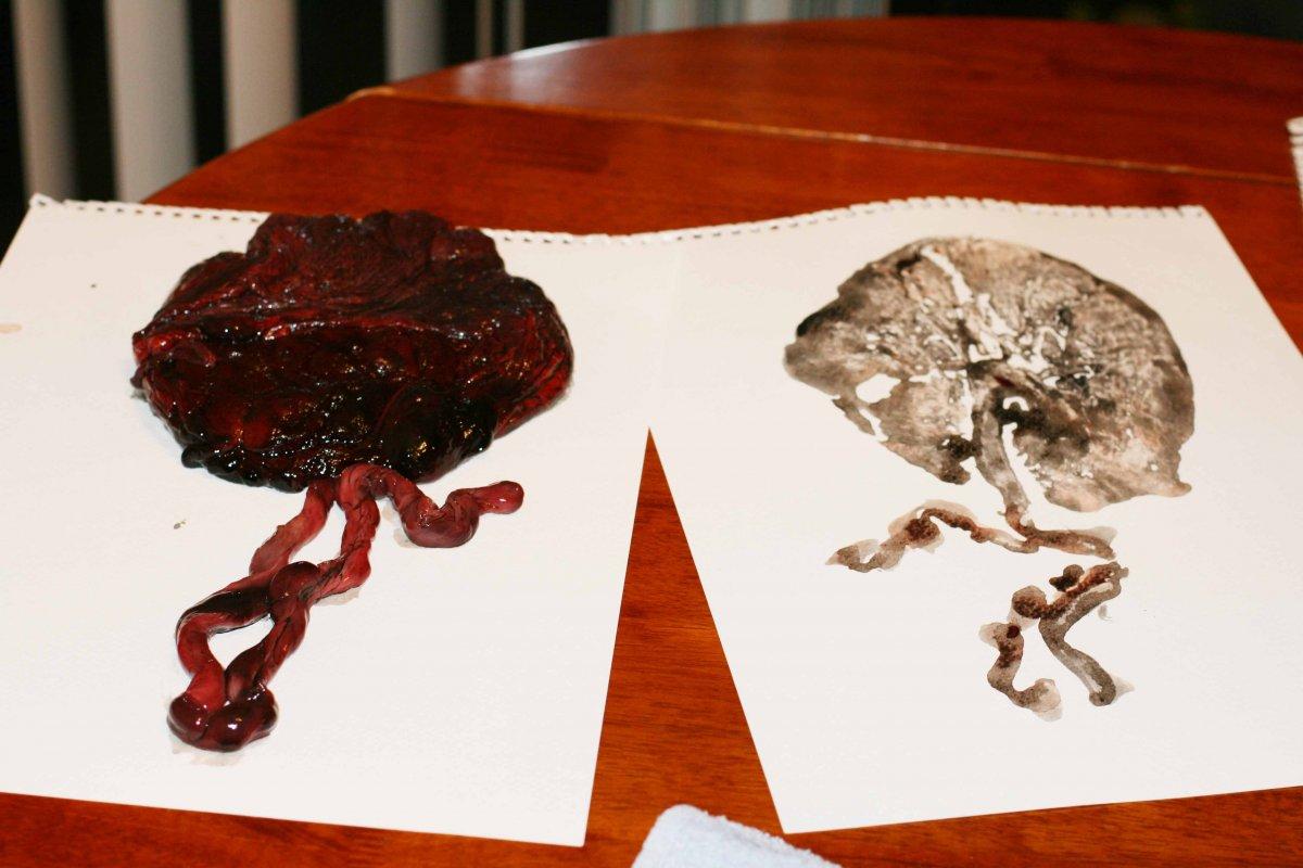 Bebeğinizden bir hatıra: Plasenta baskısı nedir?