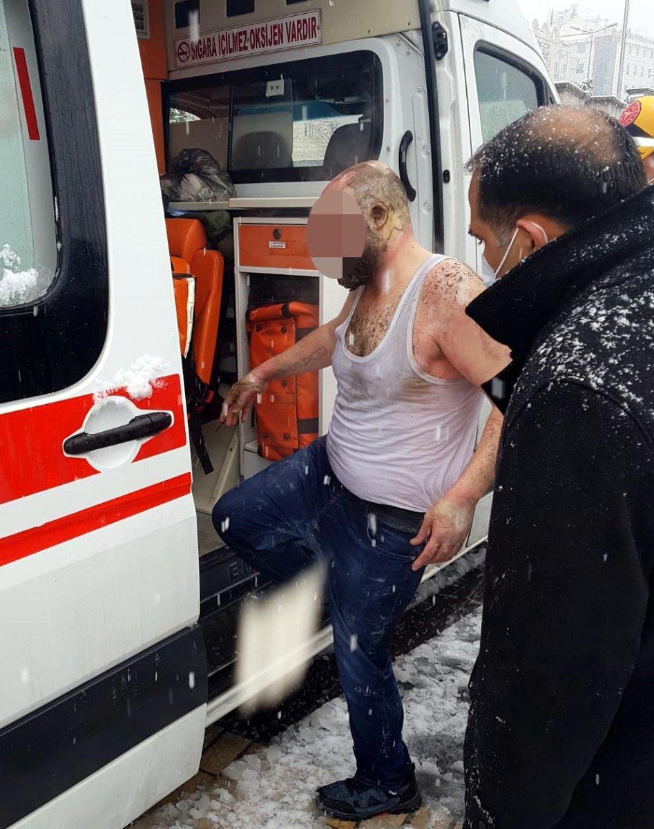 Kayseri'de ailesiyle tartışıp kendini yaktı