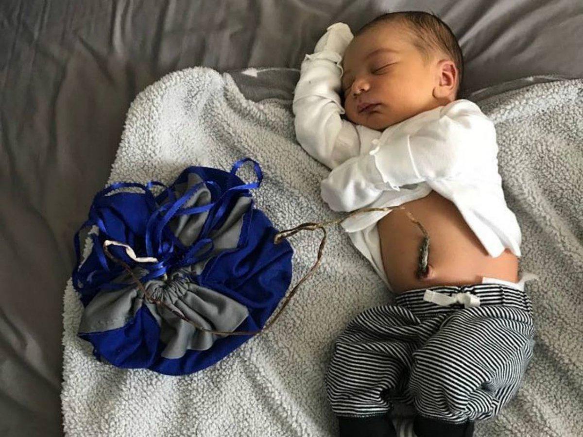 Lotus doğum nedir, nasıl yapılır? Lotus doğumun faydaları ve zararları..