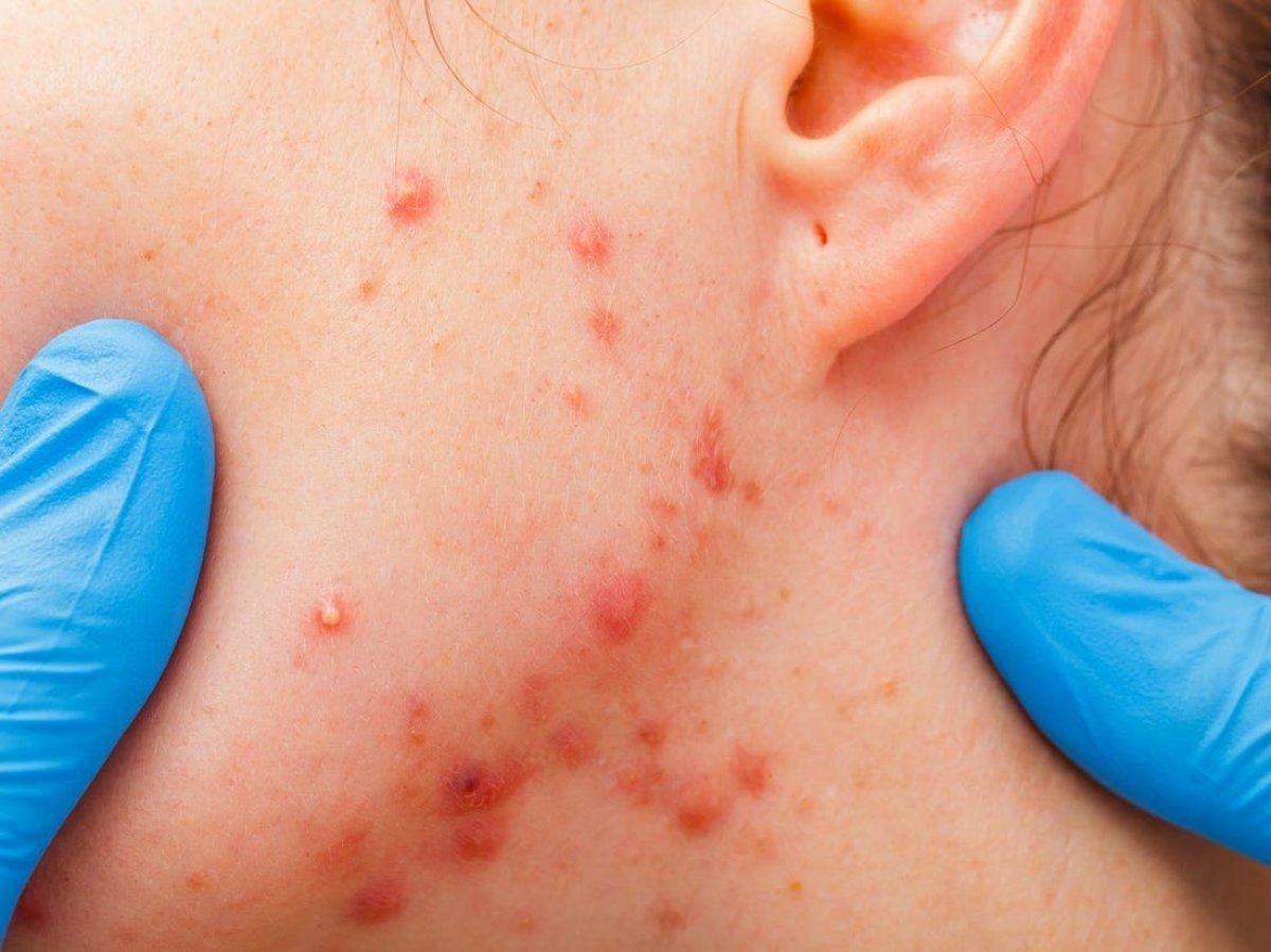 Sivilcelerin çıkış yerleri ve nedenleri