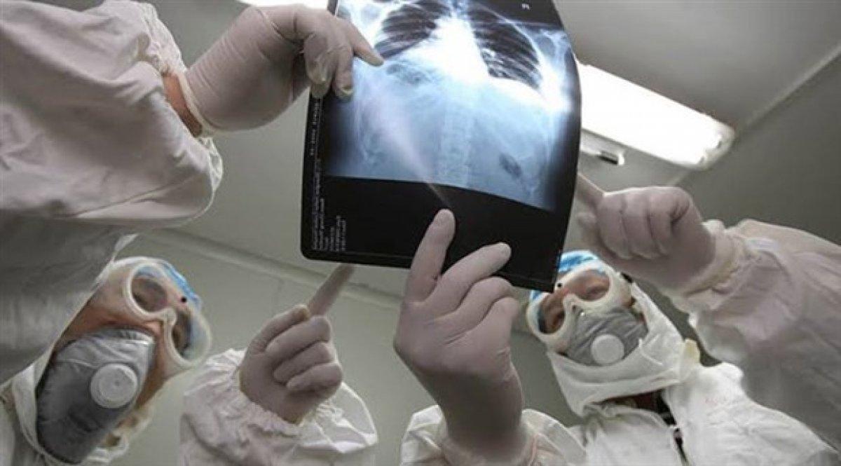 Koronavirüs ve grip nasıl ayırt edilir? Grip ve COVID-19 arasındaki farklar..