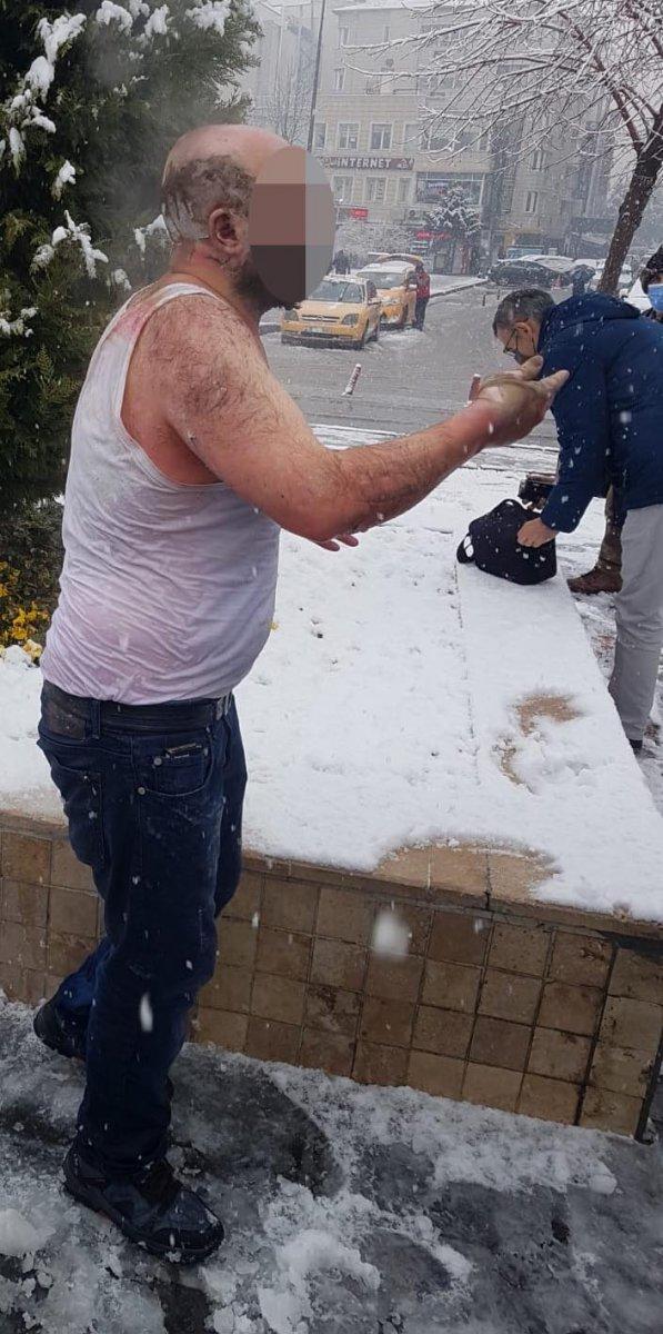 Kayseri'de ailesiyle tartışıp kendini yaktı