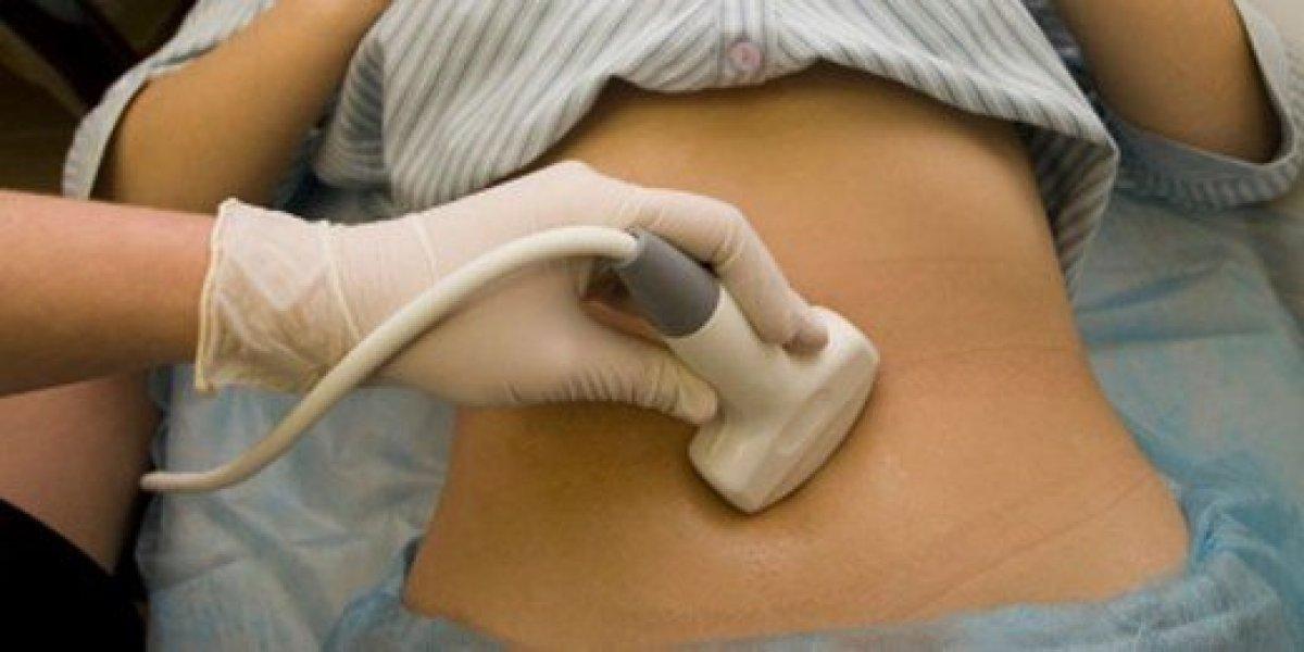 Çikolata kisti nedir, tehlikeli midir? Çikolata kisti (Endometriozis) belirtileri nelerdir?