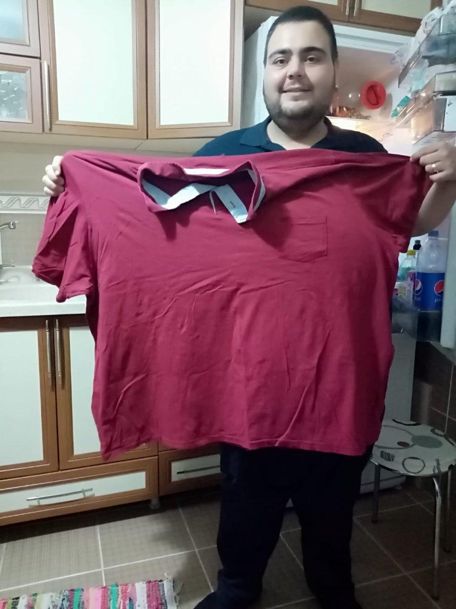 Ankaralı esnaf, mide küçültme ameliyatı ile 129 kilo verdi