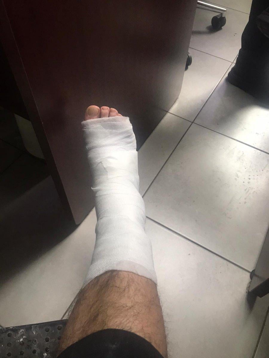 Manisa'da iki polis pitbull saldırısına uğradı